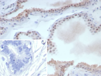 ESR2 Antibody
