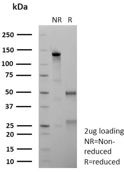 ESR2 Antibody