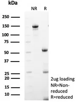 Recombinant Collagen IV alpha 5 chain / COL4A5 Antibody