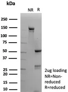 Recombinant Calponin-1 (Smooth Muscle Marker) Antibody
