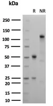Recombinant Ksp-Cadherin (Kidney-Specific Cadherin) / CDH16 Antibody