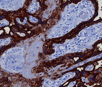 ALPP Antibody