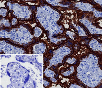 ALPP Antibody
