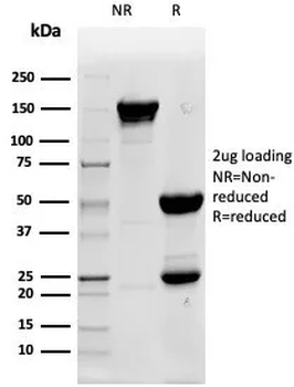 Recombinant Alkaline Phosphatase (Placental) / PLAP (Germ Cell Tumor Marker) Antibody