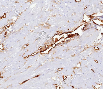 CD34 Antibody