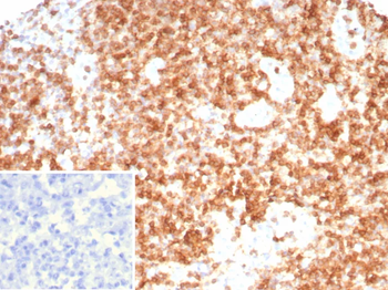 CD3G / CD3beta1 / TCR beta Antibody