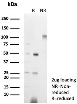 CD3G / CD3beta1 / TCR beta Antibody