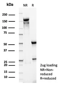 BCL6 Antibody