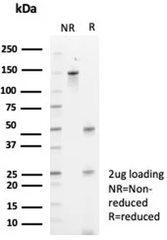 Recombinant CD91 / LDL Receptor Related Protein 1 (LRP1) Antibody