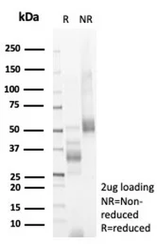 Recombinant Inhibin, alpha (INHA) (Gonadal Cell Marker) Antibody