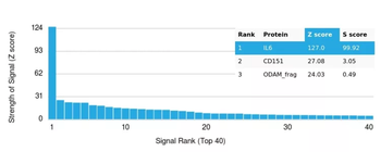 IL-6 (Interleukin-6) / Interferon beta-2 (Hybridoma Growth Factor) Antibody