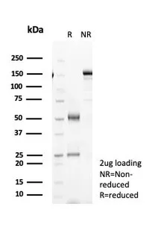 IL-6 (Interleukin-6) / Interferon beta-2 (Hybridoma Growth Factor) Antibody