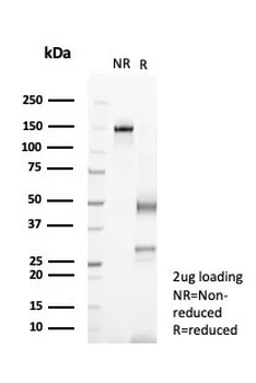 IL-6 (Interleukin-6) / Interferon beta-2 (Hybridoma Growth Factor) Antibody