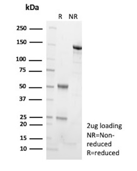 ADCY8 (Adenylate Cyclase 8) Antibody