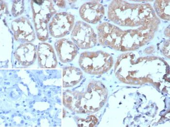 ADCY8 (Adenylate Cyclase 8) Antibody