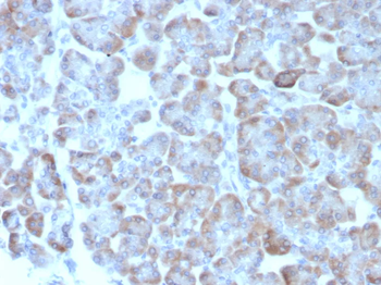 ADCY8 (Adenylate Cyclase 8) Antibody