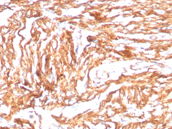 Recombinant N-Cadherin / Cadherin-2 / CD325 (NCAD) Antibody