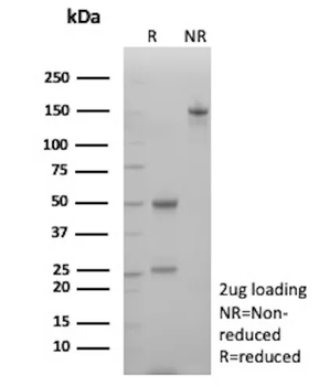 Recombinant N-Cadherin / Cadherin-2 / CD325 (NCAD) Antibody
