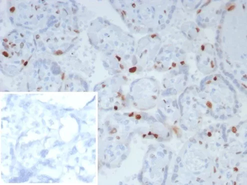 CDKN1C Antibody