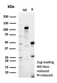 CDKN1C Antibody
