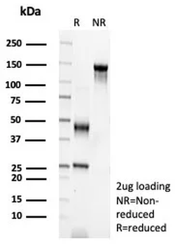 Recombinant EGFR (Epidermal Growth Factor Receptor) Antibody