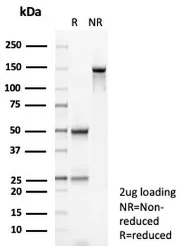 Recombinant Glutathione S-Transferase Mu3 (GSTM3) Antibody