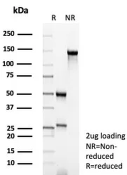 Recombinant Chromogranin A / CHGA (Neuroendocrine Marker) Antibody