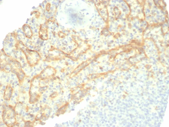 HAVCR2 Antibody
