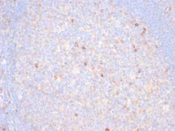 HAVCR2 Antibody