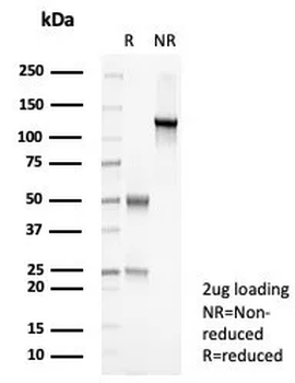 Prostein (p501S) / Solute Carrier Family 45 Member 3 (SLC45A3) Antibody