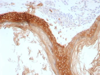 Recombinant Cytokeratin, Basic (Type II or HMW) (Epithelial Marker) Antibody