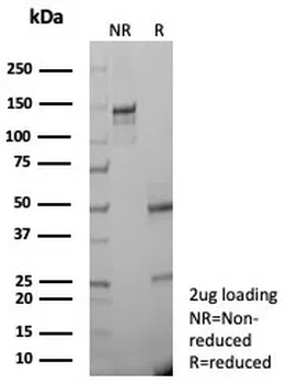 Recombinant Cytokeratin, Basic (Type II or HMW) (Epithelial Marker) Antibody