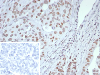 ARID1A Antibody