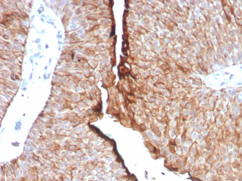 UPK1B Antibody