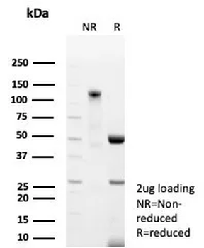 UPK1B Antibody