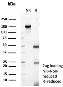 THBS1 Antibody