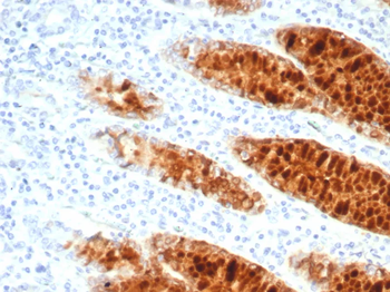 TFF1 Antibody