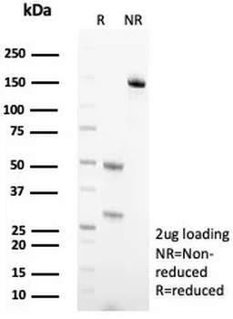 TF Antibody