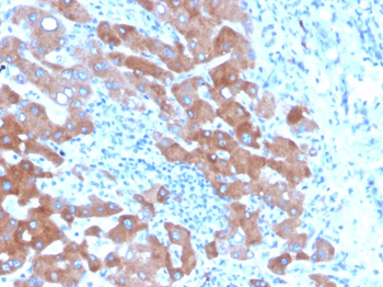 TF Antibody