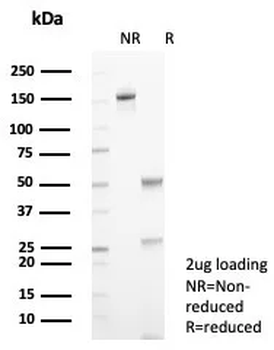 TF Antibody