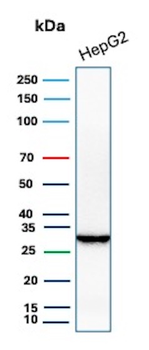 SDHB Antibody