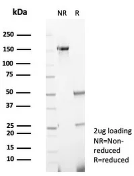 CD138 / Syndecan-1 (SDC1) (Plasma Cell Marker) Antibody