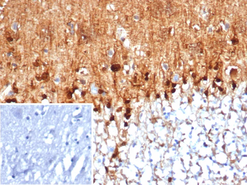 S100B Antibody