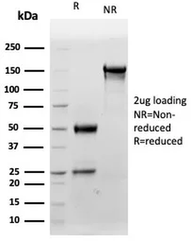 S100B Antibody