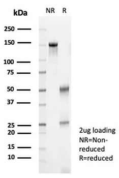 Recombinant S100A12 / CGRP Antibody