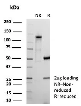 Recombinant S100A14 (S100 calcium binding protein A14) Antibody