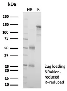 LINE1 type transposase domain containing 1 / L1TD1 Antibody