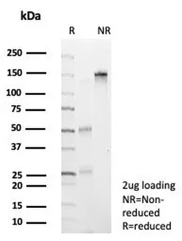NEUROG3 / Neurogenin 3 / NGN3 (Transcription Factor) Antibody