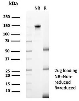 Langerin / CD207 (Marker of Langerhans Cells) Antibody