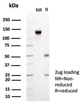KCNIP2 / KCHIP2 Antibody